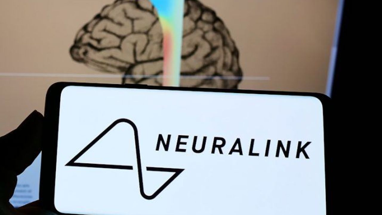 Elon Musk's Neuralink is ready to implant brain chips: The terms are clear!