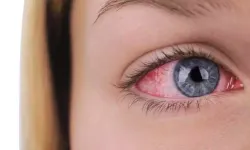 Be careful if you have this symptom in your eyes: It could be an indication that your blood vessels are blocked!