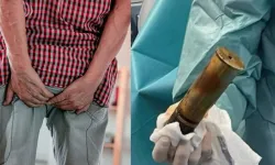 No way! 88-year-old man had a bomb in his anus!