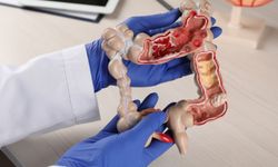 Test developed to detect colon cancer with 83 percent accuracy!