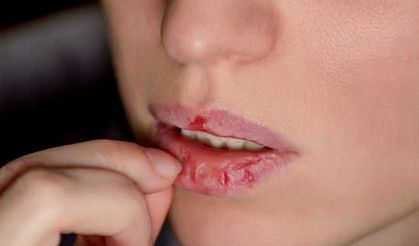 Shocking natural method that makes lips dry and cracked from the cold like cotton in seconds!