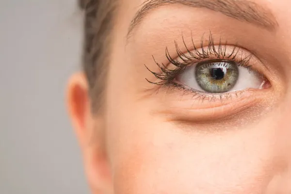 You can remove under-eye bags with eye creams or under-eye masks. However, you can get faster and more effective results with this natural method. With this method, your eye area will look 10 years younger!